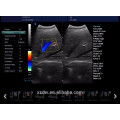 Doppler vascular y ecografía doppler color precio DW-C80